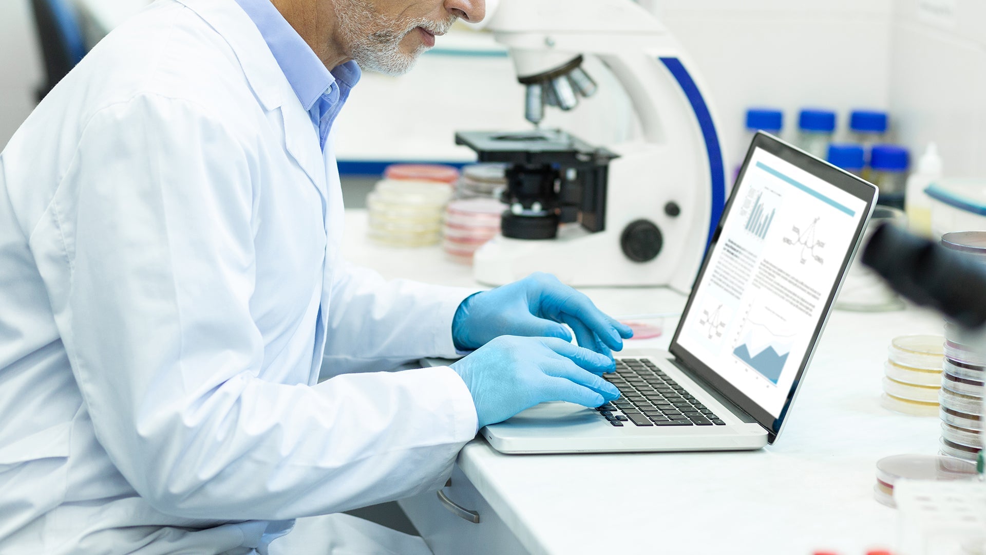 איך לחזק שרירים בשנת 2024