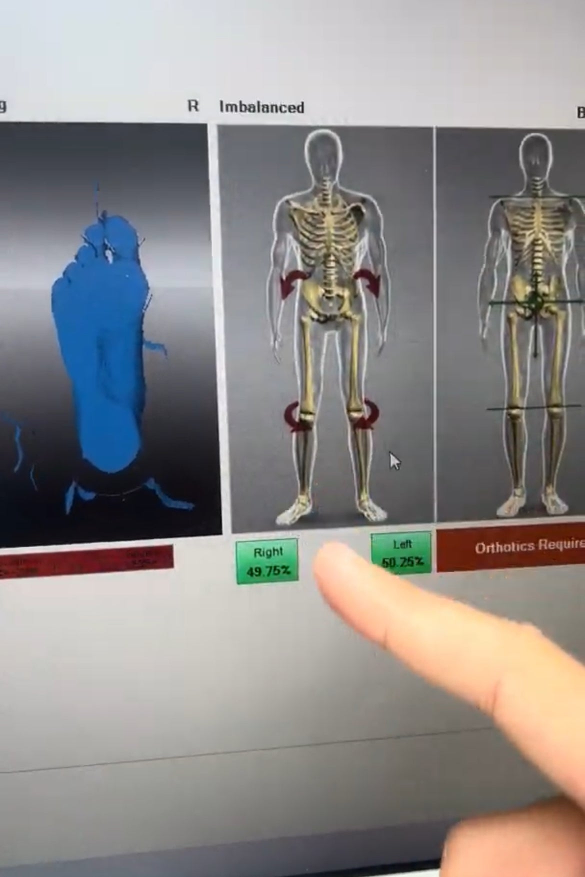 "סקירה ממוחשבת של יציבה עם מכשיר עיסוי לגב ושיקום מפציעה בגב תחתון"